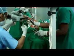 Infomative Article: Non-Surgical VS Surgical! Vocal Surgery